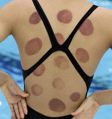La mode à pois